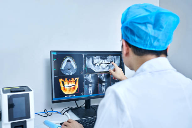 Best Emergency Root Canal Treatment in New Sharon, IA